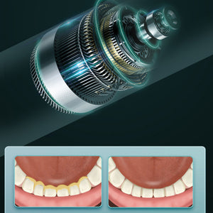 Ultrasonic tartar removal household teeth cleaning device